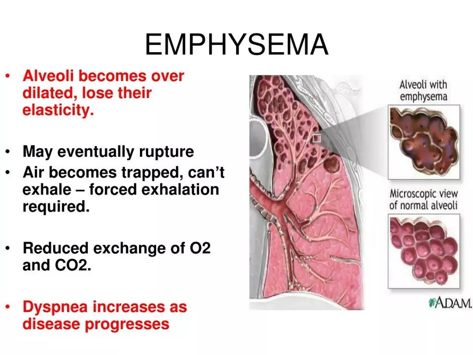 Coping with Emphysema: Strategies for Daily Life