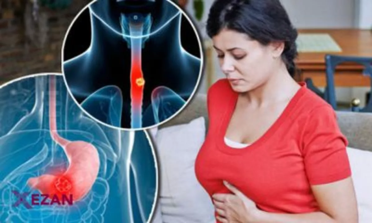 The link between acid reflux and coughing